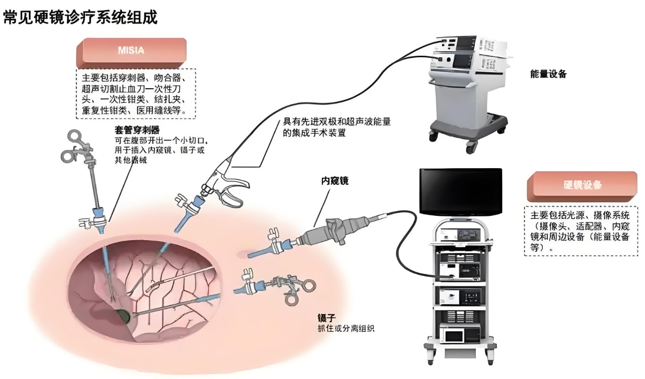 常見(jiàn)硬鏡診療系統組成